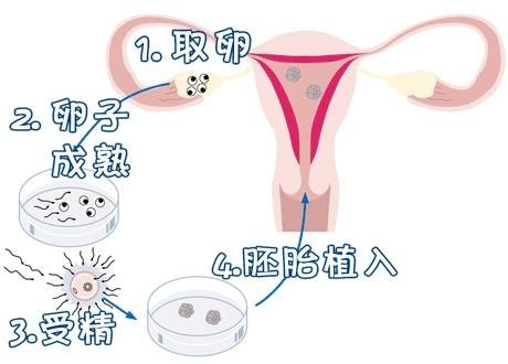 爱心同性供卵代孕微信群生殖医学中心